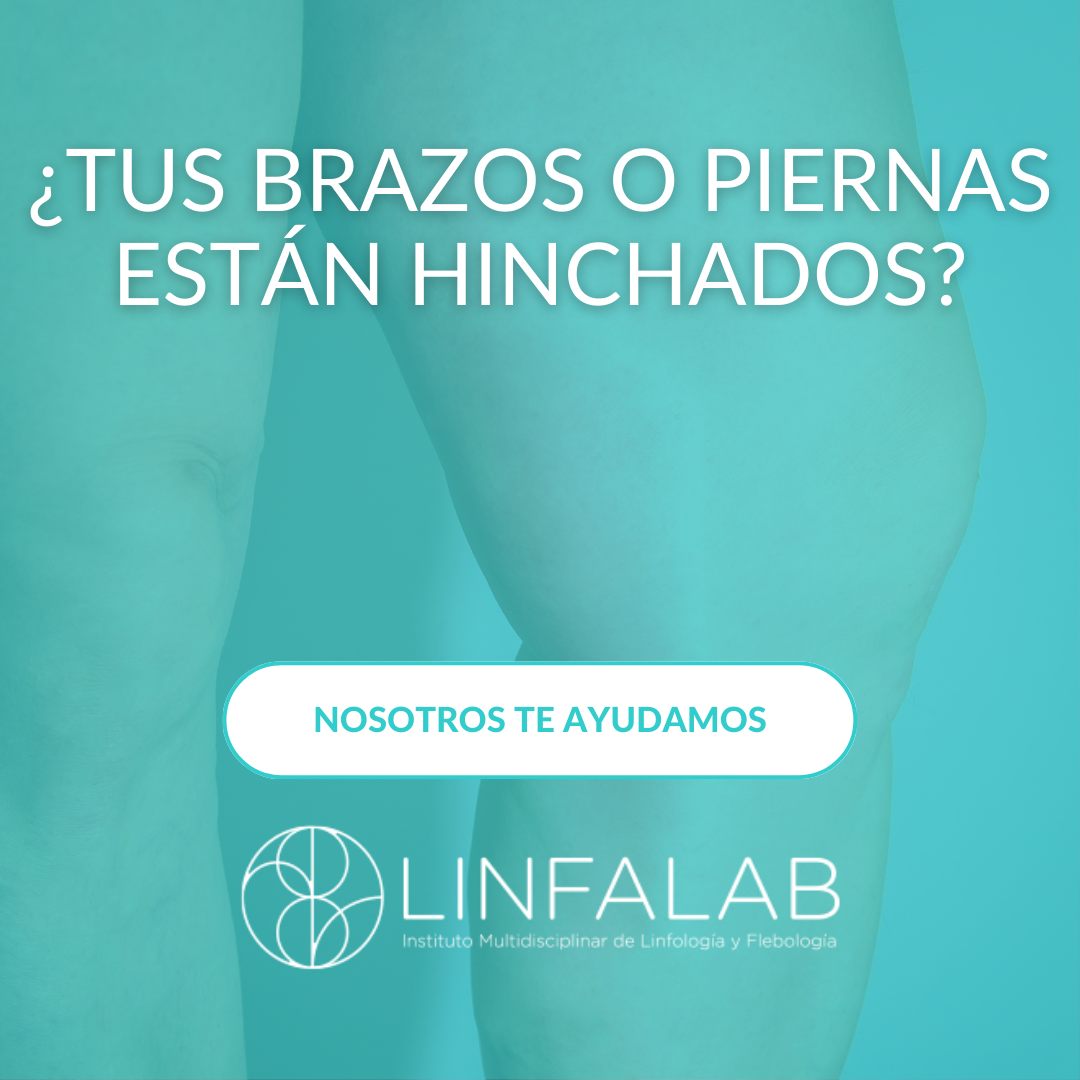 Brazos y Piernas Hinchados - slide 2 - LINFALAB.COM